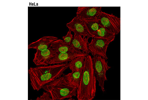 Confocal immunofluorescent analysis of HeLa cells using NUP98 (C39A3) Rabbit mAb (Alex Fluor ® 488 Conjugate) (green). Actin filaments were labeled with DyLight™ 554 Phalloidin (red).