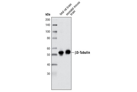 Western blot analysis of extracts from fetal rat and neonatal mouse brain using β3-Tubulin (TU-20) Mouse mAb.