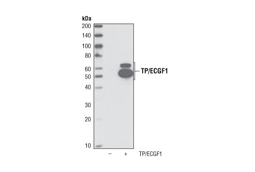 Western blot analysis of extracts from COS cells transfected with human ECGF1 using TP/ECGF1 Antibody.