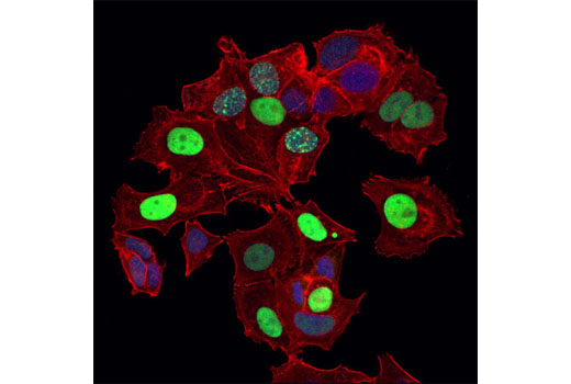 Confocal immunofluorescent analysis of MCF7 cells using p21 Waf1/Cip1 (12D1) Rabbit mAb (Alexa Fluor® 488 Conjugate) (green). Actin filaments were labeled with DY-554 phalloidin (red). Blue pseudocolor = DRAQ5 ® #4084 (fluorescent DNA dye).