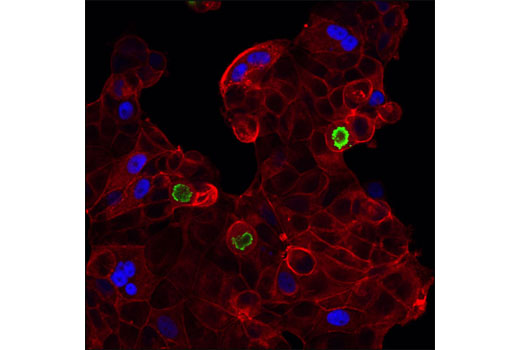 Confocal immunofluorescent analysis of MCF7 cells using p21 Waf1/Cip1 (12D1) Rabbit mAb (Alexa Fluor ® 647 Conjugate) (blue pseudocolor) and Phospho-Histone H3 (Ser10) (D2C8) XP ® Rabbit mAb (Alexa Fluor ® 488 Conjugate) #3465 (green). Actin filaments were labeled with DY-544 phalloidin (red).