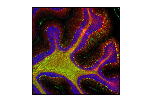 Confocal immunofluorescent image of rat cerebellum labeled with β3-Tubulin (TU-20) Mouse mAb (green) and Neurofilament-L (C28E10) Rabbit mAb #2837 (red). Blue pseudocolor = DRAQ5 ® #4084 (fluorescent DNA dye).