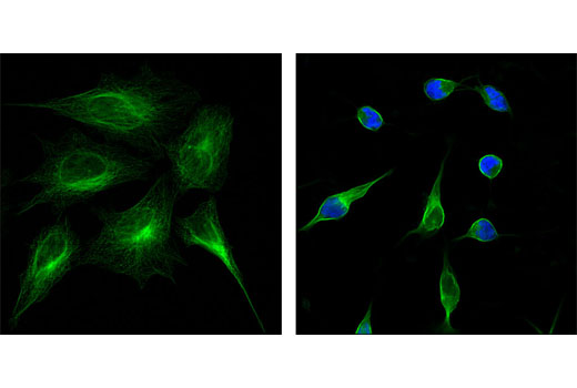 Confocal immunofluorescent analysis of HeLa cells, untreated (left) or treated with staurosporine #9953 (1 μM for 3 hours, right), using Cleaved PARP (Asp214) (D64E10) XP ® Rabbit mAb (Alexa Fluor ® 647 Conjugate) (blue pseudocolor) and β-Tubulin (9F3) Rabbit mAb (Alexa Fluor ® 488 Conjugate) #3623 (green).
