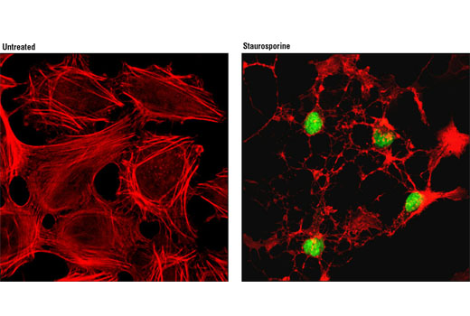 Confocal immunofluorescent analysis of HeLa cells, untreated (left) or treated with staurosporine #9953 (1 μM for 3 hours, right), using Cleaved PARP (Asp214) (D64E10) XP ® Rabbit mAb (Alexa Fluor ® 488 Conjugate) (green). Actin filaments were labeled with DY-554 phalloidin (red).