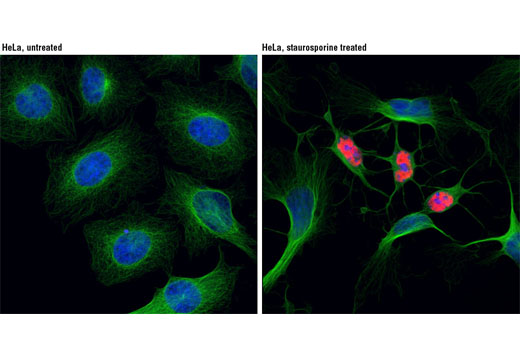 Confocal immunofluorescent analysis of HeLa cells, untreated (left) or treated with staurosporine #9953 (right) using Cleaved-PARP (Asp214) (D64E10) XP ® Rabbit mAb (Alexa Fluor ® 555 Conjugate) (red) and α-Tubulin (DM1A) Mouse mAb #3873 (green). Blue pseudocolor= DRAQ5 ® #4084 (fluorescent DNA dye).