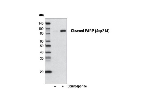 Western blot analysis of extracts from HeLa cells, untreated or treated with Staurosporine #9953 (1 μM, 3 hr) using Cleaved PARP (Asp214) (D64E10) XP ® Rabbit mAb (Biotinylated).