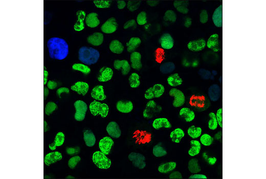 Confocal immunofluorescent analysis of NCI-H460 cells using PCNA (PC10) Mouse mAb (Alexa Fluor ® 488 Conjugate) (green), p21 Waf1/Cip1 (12D1) Rabbit mAb (Alexa Fluor ® 647 Conjugate) #8587 (blue pseudocolor), and Phospho-Histone H3 (Ser10) (D2C8) XP ® Rabbit mAb (Alexa Fluor ® 555 Conjugate) #3475 (red).