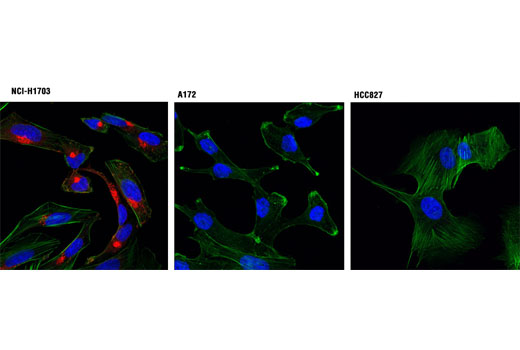 Confocal immunofluorescent analysis of NCI-H1703 (α+/β-; left), A172 (α-/β+; center), and HCC827 (α-/β-; right) cells using PDGF Receptor α (D13C6) XP ® Rabbit mAb (Alexa Fluor ® 555 Conjugate) (red). Actin filaments were labeled with Alexa Fluor ® 488 phalloidin (green). Blue pseudocolor = DRAQ5 ® #4084 (fluorescent DNA dye).