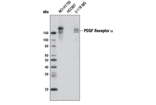 Western blot analysis of extracts from NCI-H1703, HCC827, and U-118 MG cells using PDGF Receptor α (D13C6) XP ® Rabbit mAb (Biotinylated).