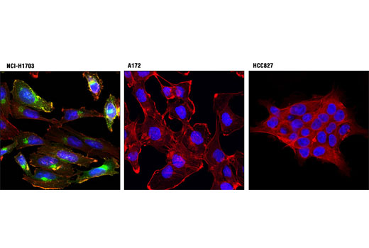Confocal immunofluorescent analysis of NCI-H1703 (α+/β-; left), A172 (α-/β+; center), and HCC827 (α-/β-; right) cells using PDGF Receptor α (D13C6) XP ® Rabbit mAb (Alexa Fluor ® 488 Conjugate) (green). Actin filaments were labeled with DY-554 phalloidin (red). Blue pseudocolor = DRAQ5 ® #4084 (fluorescent DNA dye).