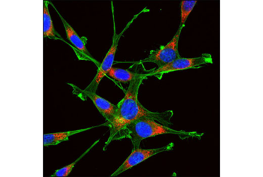 Confocal immunofluorescent analysis of NIH/3T3 cells using PDI (C81H6) Rabbit mAb (Alexa Fluor ® 594 Conjugate) (red) and β-Actin (13E5) Rabbit mAb (Alexa Fluor ® 488 Conjugate) #8844 (green). Blue pseudocolor = DRAQ5 ® #4084 (fluorescent DNA dye).