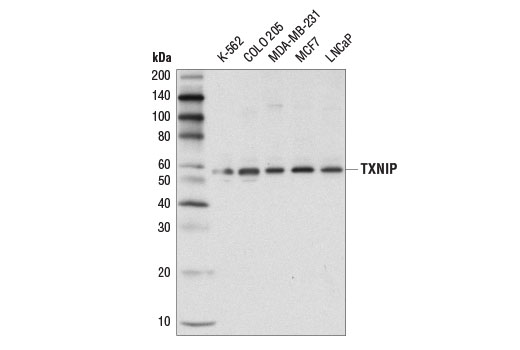 Western blot analysis of extracts from various cell lines using TXNIP (D5F3E) Rabbit mAb.