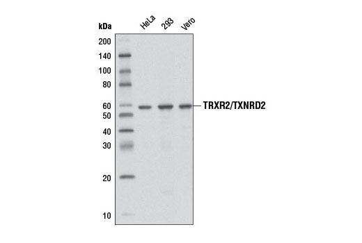 Western blot analysis of extracts from various cell lines using TRXR2/TXNRD2 (3F2-E12-F10) Mouse mAb.