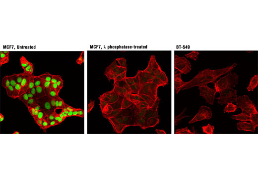 Confocal immunofluorescent analysis of untreated MCF7 (left), λ phosphatase-treated MCF7 (middle), and BT-549 (right) cells using Phospho-Rb (Ser807/Ser811) (D20B12) XP ® Rabbit mAb (Alexa Fluor ® 488 Conjugate) (green). Actin filaments were labeled with DY-554 phalloidin (red).