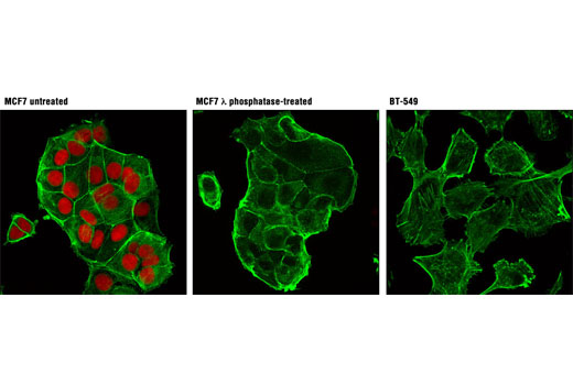 Confocal immunofluorescent analysis of MCF7 cells, untreated (left) or λ phosphatase-treated (middle), and BT-549 cells (right), using Phospho-Rb (Ser807/811) (D20B12) XP ® Rabbit mAb (Alexa Fluor ® 555 Conjugate) (red). Actin filaments were labeled with Alexa Fluor ® 488 phalloidin (green).