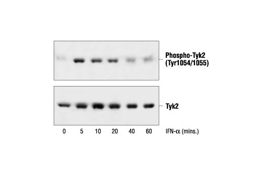 Western blot analysis of extracts from HeLa cells, untreated or interferon-α treated for the indicated times, using Phospho-Tyk2 (Tyr1054/1055) Antibody (upper) or Tyk2 Antibody #9312 (lower).
