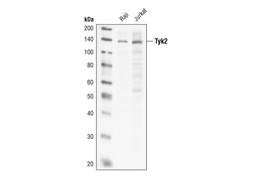 Western blot analysis of extracts from Raji and Jurkat cells, using Tyk2 Antibody.