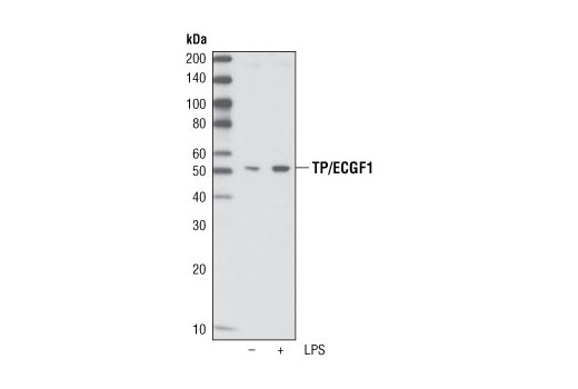 Western blot analysis of extracts from human THP-1 cells, untreated or LPS-treated overnight, using TP/ECGF1 Antibody.