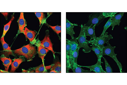 Confocal immunofluorescent analysis of C2C12 cells, treated with either insulin (left) or LY294002, U0126 and Rapamycin (right), using Phospho-S6 Ribosomal Protein (Ser235/236) (D57.2.2E) XP ® Rabbit mAb (Alexa Fluor ® 555 Conjugate) (red) and β-Catenin (L54E2) Mouse mAb (Alexa Fluor ® 488 Conjugate) (green). Blue pseudocolor = DRAQ5 ® #4084 (fluorescent DNA dye).