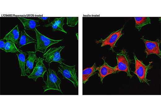Confocal immunofluorescent analysis of HeLa cells, treated with LY294002 #9901, Rapamycin #9904, and U0126 #9903 (left), or insulin-treated (right) using Phospho-S6 Ribosomal Protein (Ser235/236) (D57.2.2E) XP ® Rabbit mAb (Alexa Fluor ® 594 Conjugate) (red). Actin filaments were labeled with Alexa Fluor ® 488 phalloidin (green). Blue pseudocolor = DRAQ5 ® #4084 (fluorescent DNA dye).