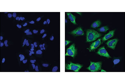 Confocal immunofluorescent analysis of HeLa cells, treated with wortmannin and U0126 (left) or PMA (right), using Phospho-S6 Ribosomal Protein (Ser235/236) (D57.2.2E) XP ® Rabbit mAb (Alexa Fluor ® 488 Conjugate). Blue pseudocolor = DRAQ5™ (fluorescent DNA dye).