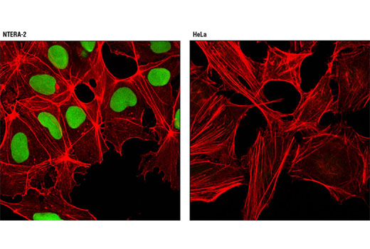 Confocal immunofluorescent analysis of NTERA-2 (left) and HeLa (right) cells using Sox2 (D6D9) XP ® Rabbit mAb (Alexa Fluor® 488 Conjugate) (green). Actin filaments were labeled with DY-554 phalloidin (red).