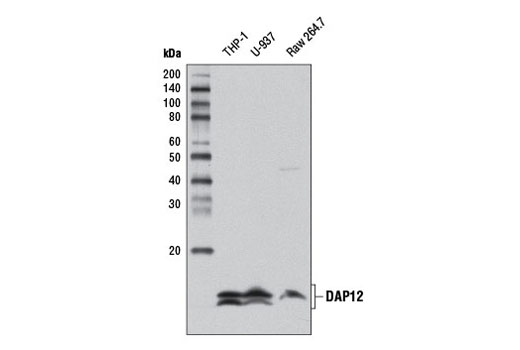 Western blot analysis of extracts from THP-1, U-937, and Raw 264.7 cells using DAP12 (D7G1X) Rabbit mAb.