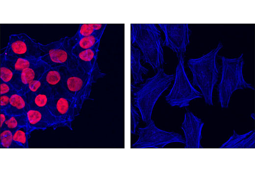 Confocal immunofluorescent analysis of NTERA2 (left) and HeLa cells (right) using Sox2 (D6D9) XP ® Rabbit mAb (Alexa Fluor ® 555 Conjugate) (red). Actin filaments were labeled with Alexa Fluor ® 647 phalloidin (blue).