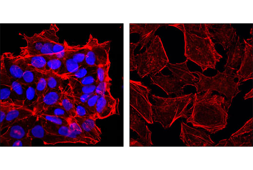 Confocal immunofluorescent analysis of NTERA2 (left) and HeLa (right) cells using Sox2 (D6D9) XP ® Rabbit mAb (Alexa Fluor® 647 Conjugate) (blue pseudocolor). Actin filaments were labeled with DY-554 phalloidin (red).