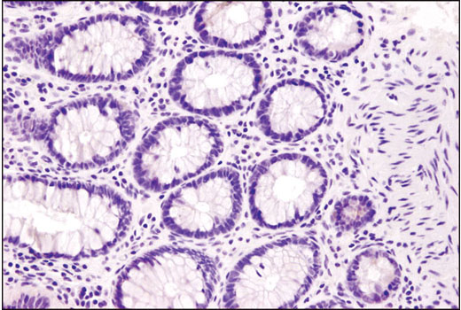 Immunohistochemical analysis of human colon tissue using Tyrosinase (T311) Mouse mAb (IHC Specific). Note the lack of staining in the tyrosinase negative tissue.
