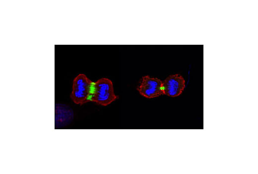 Confocal immunofluorescent image of HeLa cells labeled with Survivin (71G4) Rabbit mAb (Alexa Fluor® 488 Conjugate) (green). Actin filaments have been labeled with Alexa Fluor ® 555 phalloidin (red). Blue pseudocolor = DRAQ5 ® #4084 (fluorescent DNA dye).