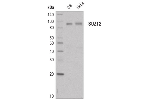 Western blot analysis of extracts from C6 and HeLa cells using SUZ12 (D39F6) XP ® Rabbit mAb (Biotinylated).