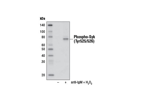 Western blot analysis of extracts from Ramos cells, untreated (-) or anti-IgM (10 μg/ml, 30 min) and hydrogen peroxide (H 2 O 2 ) (3.3mM, 25 min) treated (+), using Phospho-Syk (Tyr525/526) (C87C1) Rabbit mAb (Biotinylated). The western blot was developed using Streptavidin-HRP #3999.