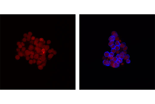 Confocal immunofluorescent analysis of Ramos cells untreated (left), or treated with anti-IgM (right), using Phospho-Syk (Tyr525/526) (C87C1) Rabbit mAb (Alexa Fluor® 647 Conjugate) (blue pseudocolor). Red = Propidium Iodide (PI)/RNase Staining Solution #4087.