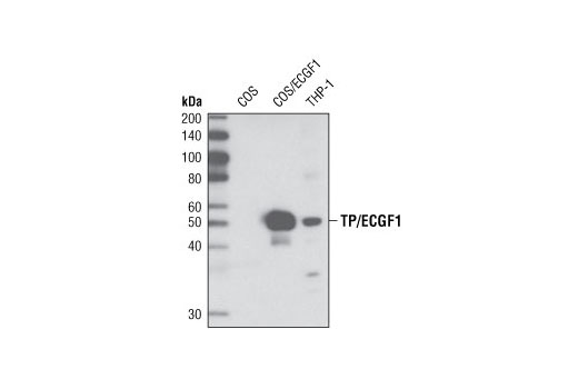 Western blot analysis of extracts from COS cells, untransfected or transfected with human ECGF1, and human THP-1 cells, using Thymidine Phosphorylase/ECGF1 (D69B12) Rabbit mAb.
