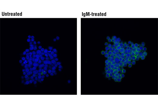 Confocal immunofluorescent analysis of Ramos cells, untreated (left) or treated with IgM (12 ug/ml, 2 min) (right), using Phospho-Syk (Tyr525/526) (C87C1) Rabbit mAb (Alexa Fluor ® 488 Conjugate) (green). Blue Pseudocolor = DRAQ5 ® #4084 (fluorescent DNA dye).