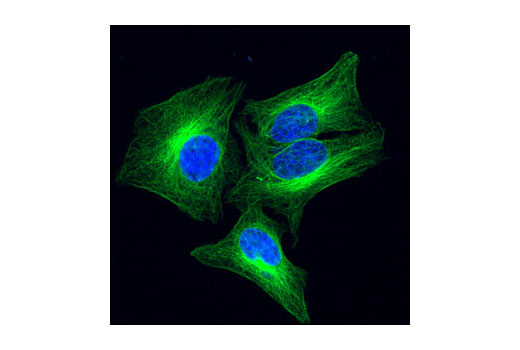 Confocal immunofluorescent analysis of HeLa cells using β-Tubulin (9F3) Rabbit mAb (Alexa Fluor® 488 Conjugate) (green). Blue pseudocolor = DRAQ5 ® #4084 (fluorescent DNA dye).