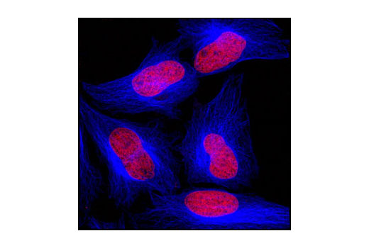 Confocal immunofluorescent analysis of HeLa cells using β-Tubulin (9F3) Rabbit mAb (Alexa Fluor ® 647 Conjugate) (blue pseudocolor). Red = Propidium Iodide (fluorescent DNA dye).