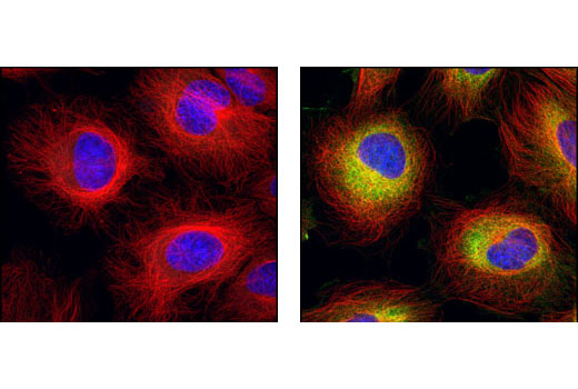 Confocal immunofluorescent analysis of HeLa cells, serum-starved (left) or 20% serum-treated (right), using β-Tubulin (9F3) Rabbit mAb (Alexa Fluor ® 555 Conjugate) (red) and Phospho-S6 Ribosomal Protein (Ser235/236) (2F9) Rabbit mAb (Alexa Fluor ® 488 Conjugate) #4854 (green). Blue pseudocolor = DRAQ5 ® #4084 (fluorescent DNA dye).
