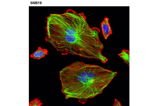 Confocal immunofluorescent analysis of SNB19 cells using Vimentin (D21H3) XP ® Rabbit mAb (Alexa Fluor ® 488 Conjugate) (green). Actin filaments were labeled with DY-554 phalloidin (red). Blue pseudocolor = DRAQ5 ® #4084 (fluorescent DNA dye).