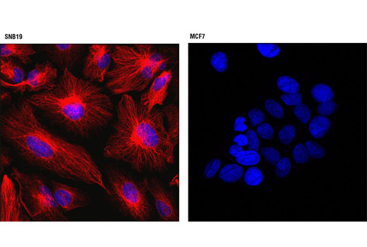 Confocal immunofluorescent analysis of SNB19 (left) or MCF7 (right) cells using Vimentin (D21H3) XP ® Rabbit mAb (Alexa Fluor ® 555 Conjugate) (red). Blue pseudocolor = DRAQ5 ® #4084 (fluorescent DNA dye).