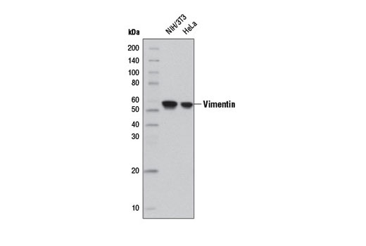 Western blot analysis of extracts from NIH/3T3 and HeLa cells using Vimentin (D21H3) XP ® Rabbit mAb (HRP Conjugate).