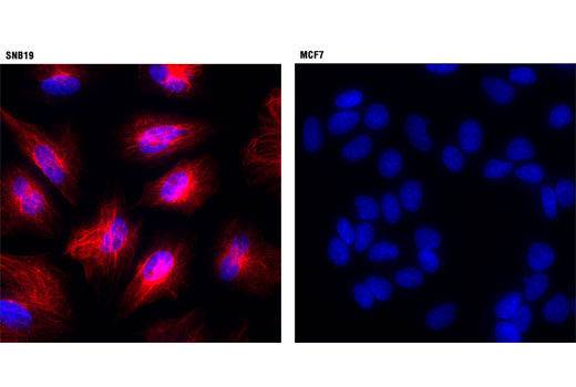Immunofluorescent analysis of SNB19 (left) and MCF7 (right) cells using Vimentin (D21H3) XP ® Rabbit mAb (Alexa Fluor ® 594 Conjugate) (red). Blue pseudocolor = DRAQ5 ® #4084 (fluorescent DNA dye).