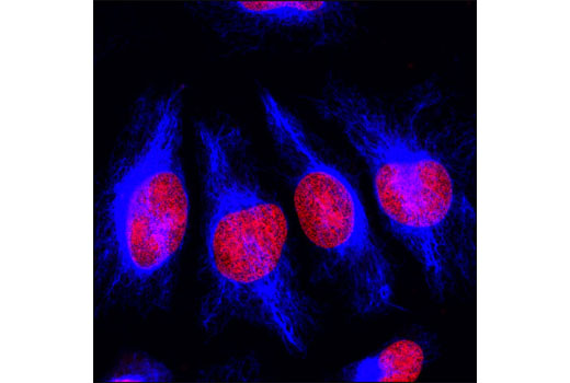 Confocal immunofluorescent analysis of HeLa cells using Vimentin (D21H3) XP ® Rabbit mAb (Alexa Fluor ® 647 Conjugate) (blue pseudocolor). Red = Propidium Iodide (fluorescent DNA dye)