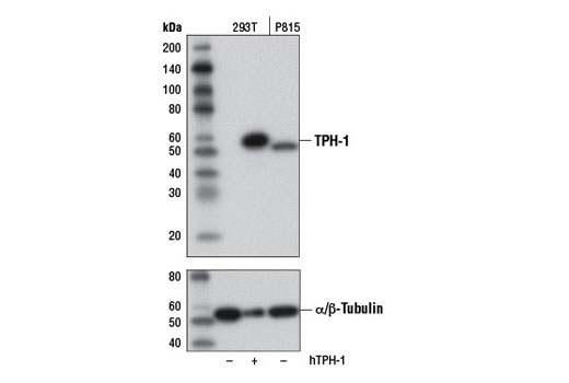 Western blot analysis of extracts from 293T cells, mock transfected (-) or transfected with a construct expressing full-length human TPH-1 (hTPH-1; +) and P815 cells, using TPH-1 (D10C10) Rabbit mAb (upper) or α/β-Tubulin Antibody #2148 (lower).