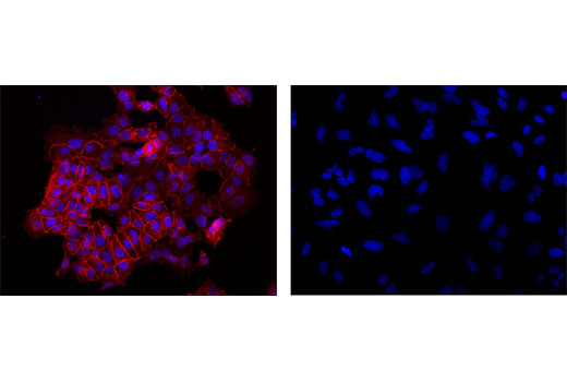 Confocal immunofluorescent analysis of MCF-7 (left) and HeLa (right) cells using E-Cadherin (24E10) Rabbit mAb (Alexa Fluor ® 555 Conjugate) (red). Blue pseudocolor = DRAQ5 ® #4084 (fluorescent DNA dye).