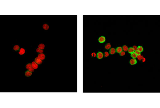Confocal immunofluorescent analysis of Ramos cells, serum starved (left) or treated with IgM (12 μg/mL for 10 min, right) using Phospho-HS1 (Tyr397) (D12C1) XP ® Rabbit mAb (Alexa Fluor ® 488 Conjugate) (green). Red = Propidium Iodide (PI)/RNase Staining Solution #4087 (fluorescent DNA dye).
