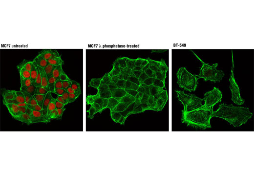 Confocal immunofluorescent analysis of MCF7 cells, untreated (left) or λ phosphatase-treated (middle), and BT-549 cells (right), using Phospho-Rb (Ser807/811) (D20B12) XP ® Rabbit mAb (Alexa Fluor ® 594 Conjugate) (red). Actin filaments were labeled with Alexa Fluor ® 488 phalloidin (green).