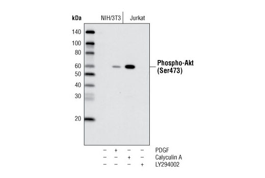 Western blot analysis of extracts from NIH/3T3 and Jurkat cells, untreated or treated with either PDGF, Calyculin A or LY294002 #9901 as indicated, using Phospho-Akt (Ser473) (D9E) XP ® Rabbit mAb (HRP Conjugate).