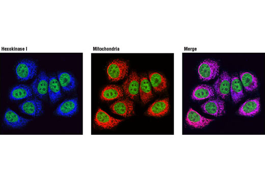 Confocal immunofluorescent analysis of MCF-7 cells using Hexokinase I (C35C4) Rabbit mAb (Alexa Fluor ® 647 Conjugate) (blue pseudocolor) and MitoTracker ® Red CMXRos (red) showing colocalization with mitochondria. Nuclei have been labeled with p53 (1C12) Mouse mAb (Alexa Fluor ® 488 Conjugate) #2015 (green).